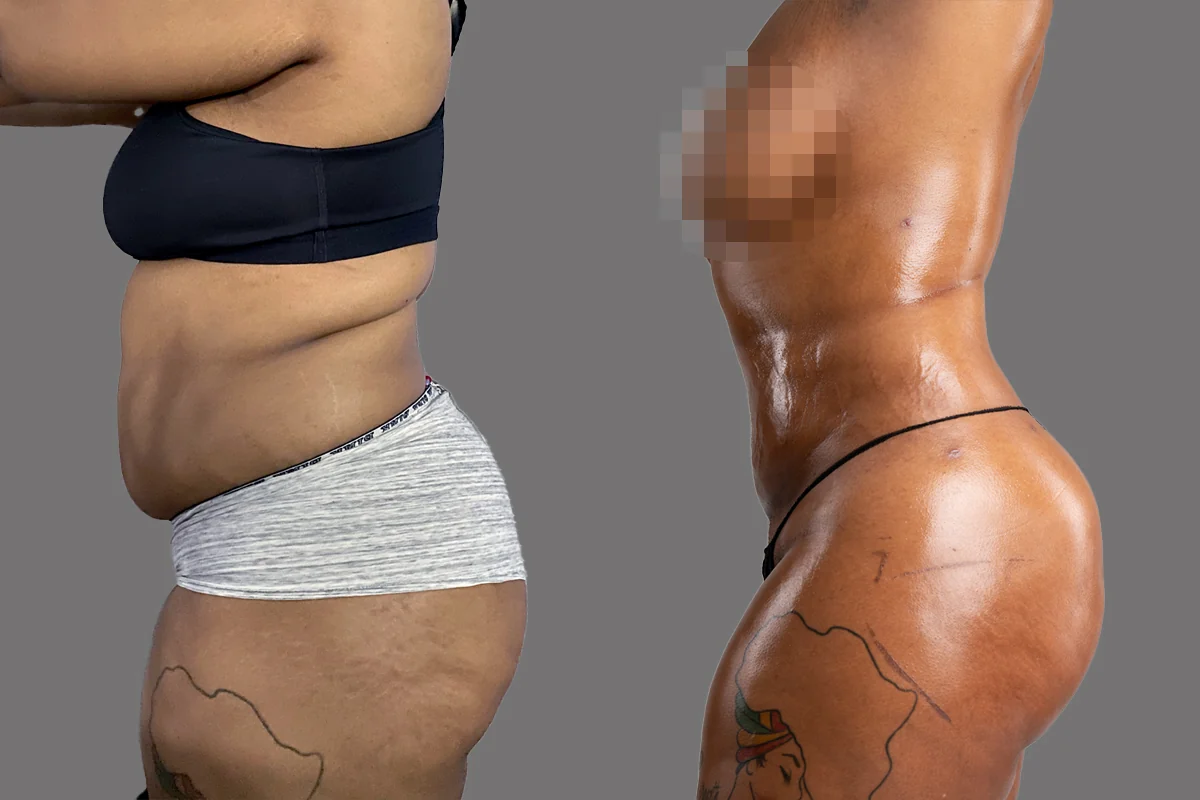 Before and after, patient 5