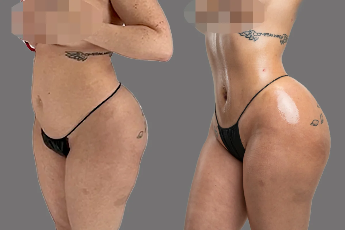 Before and after, patient 6