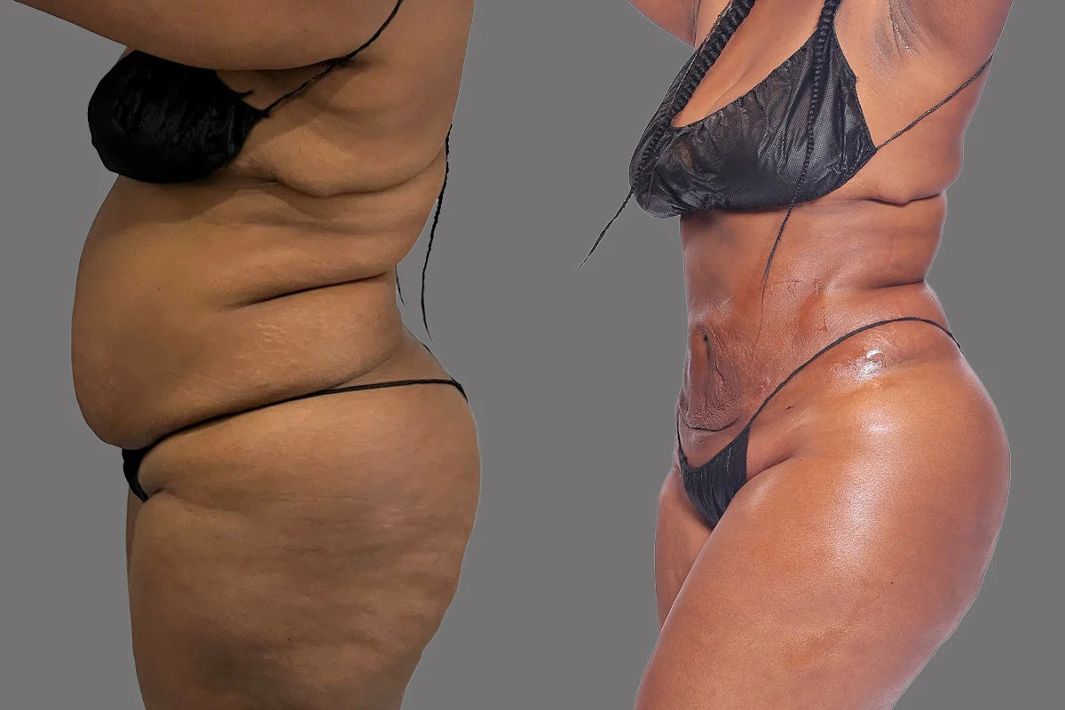 Before and after, patient 2