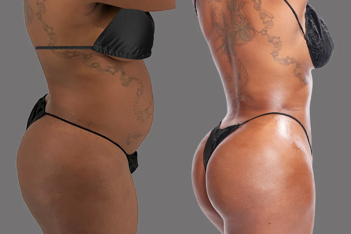 Before and after — Brooklyn, patient 3