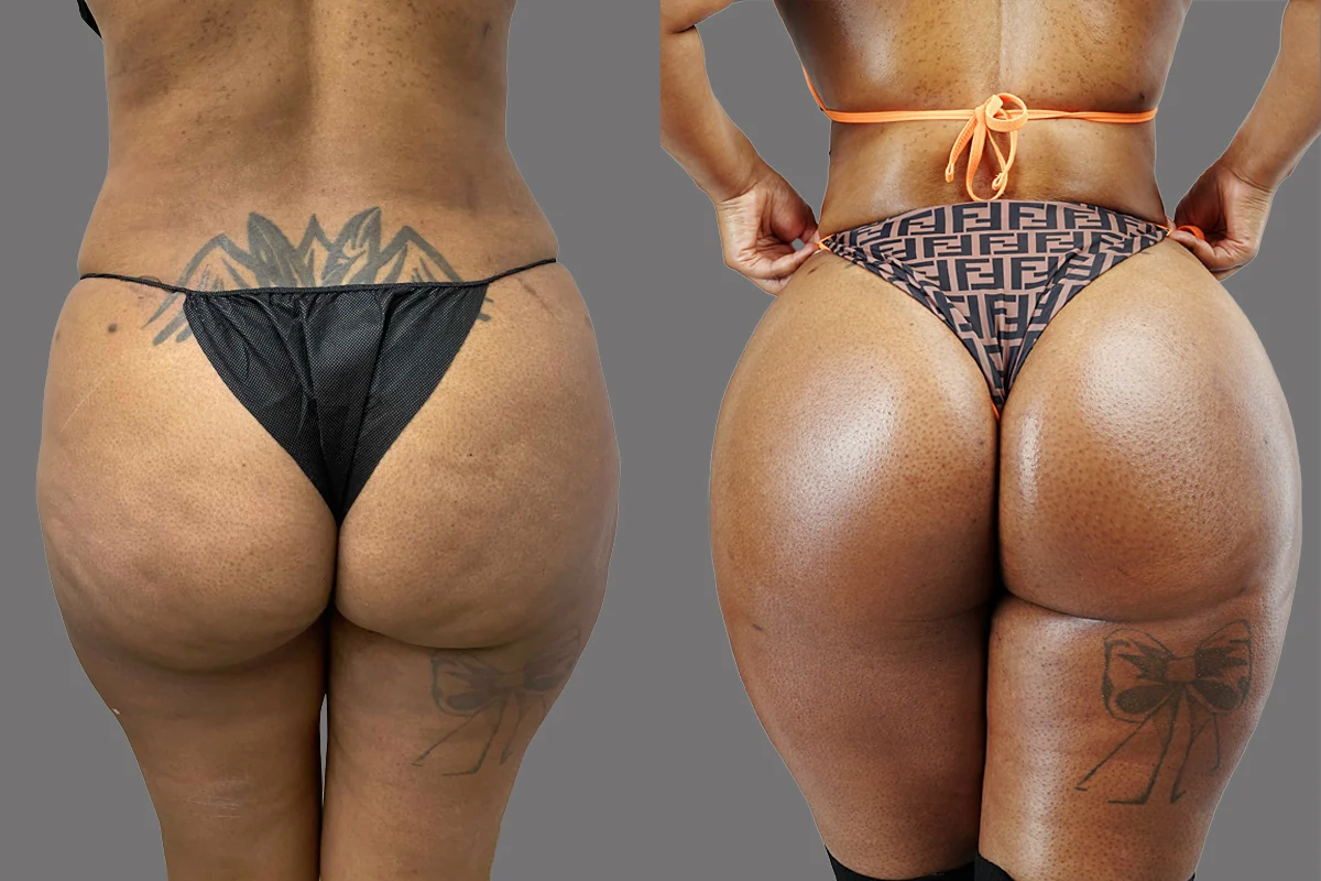 Before and after, patient 2