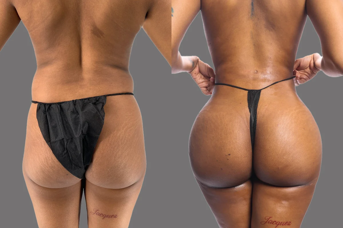 Before and after, patient 3