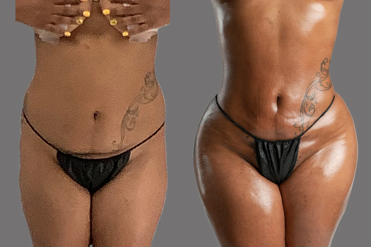 Before and after, patient 1