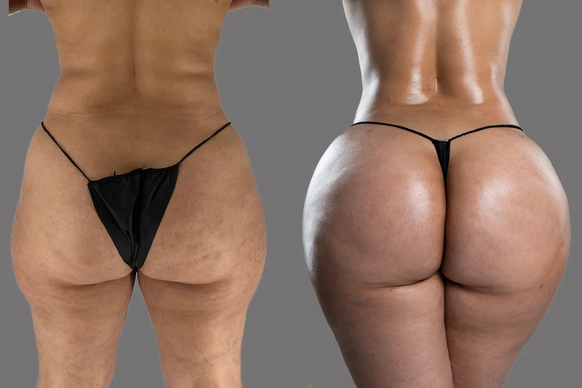 Before and after, patient 2