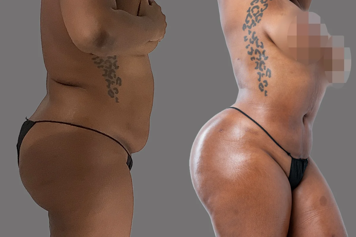 Before and after, patient 3