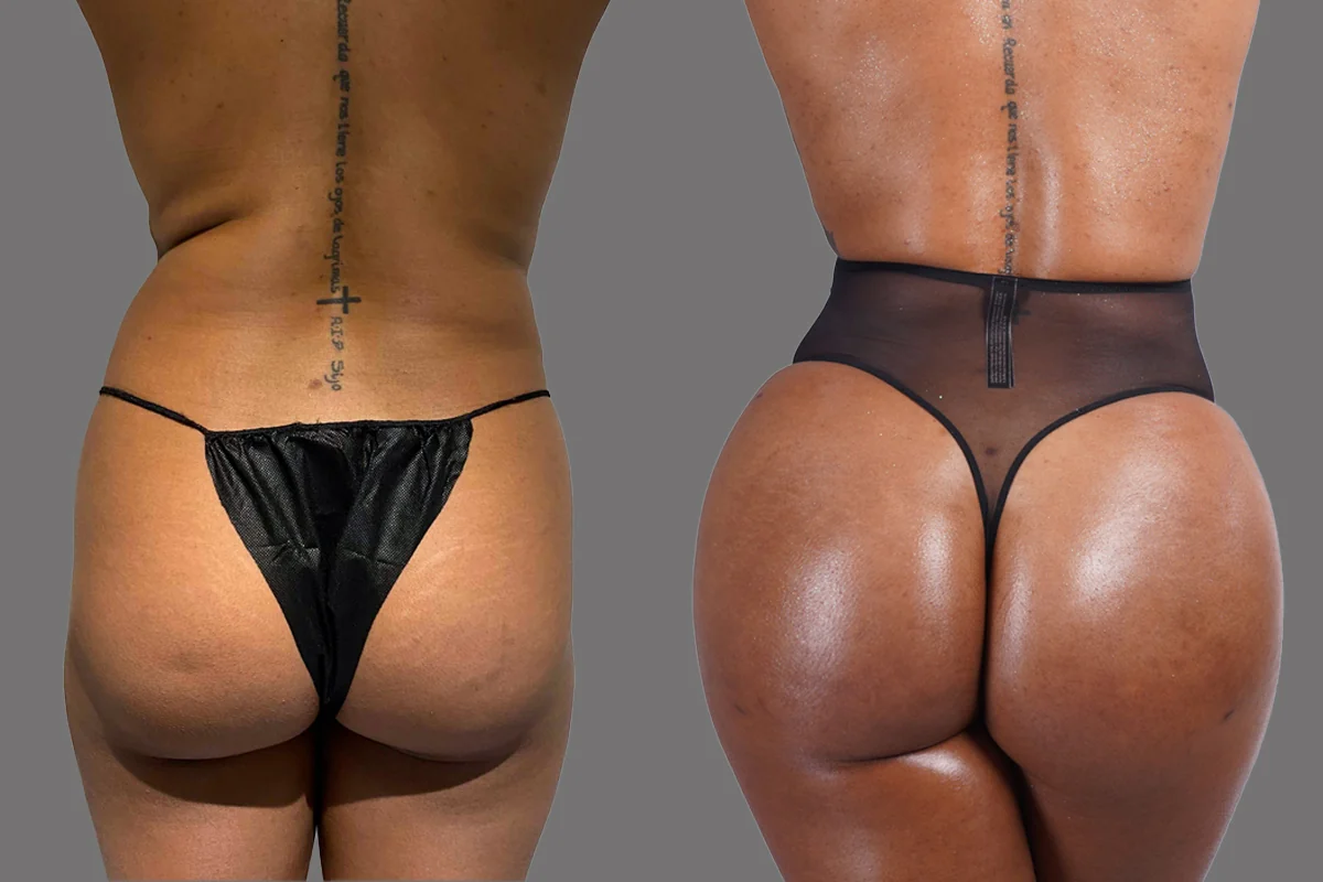 Before and after, patient 4
