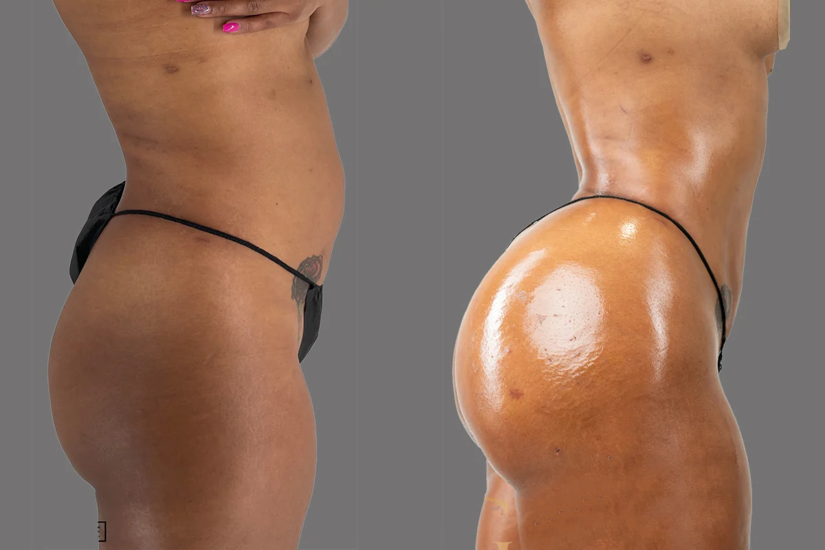 Before and after — Ridgefield, patient 4