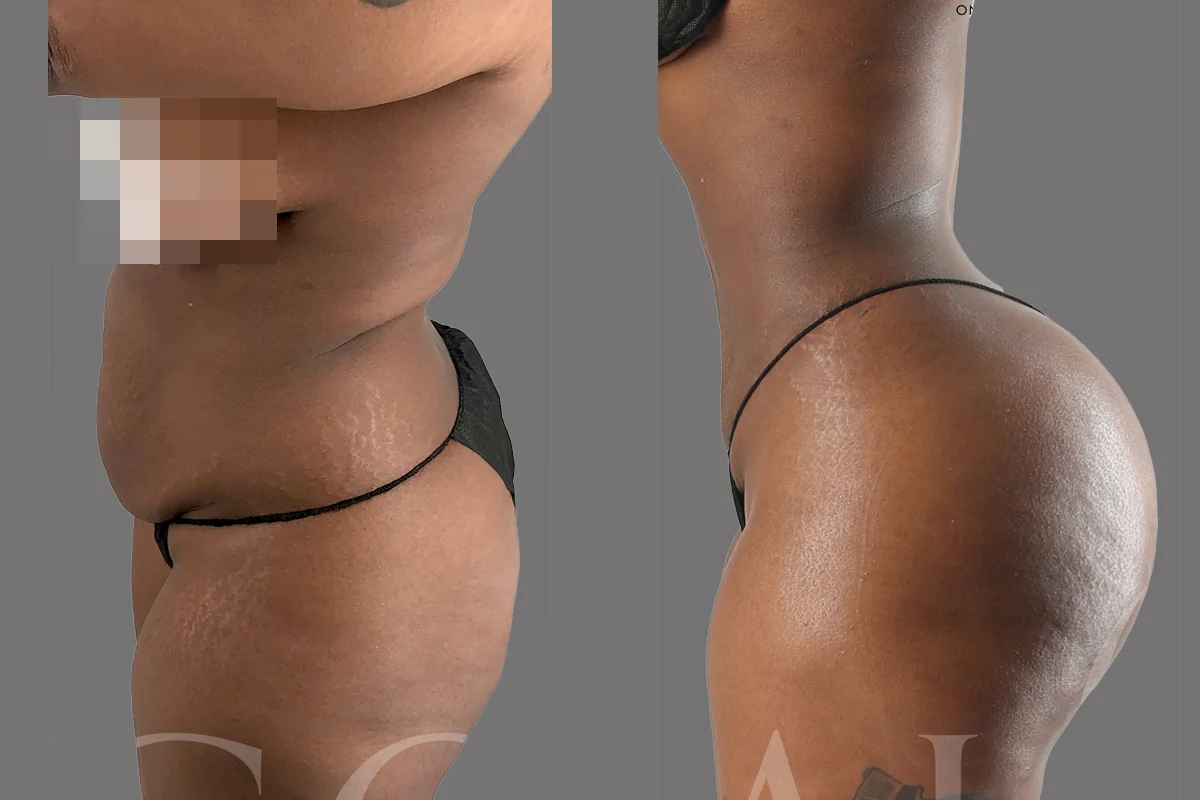 Before and after — Ridgefield, patient 6
