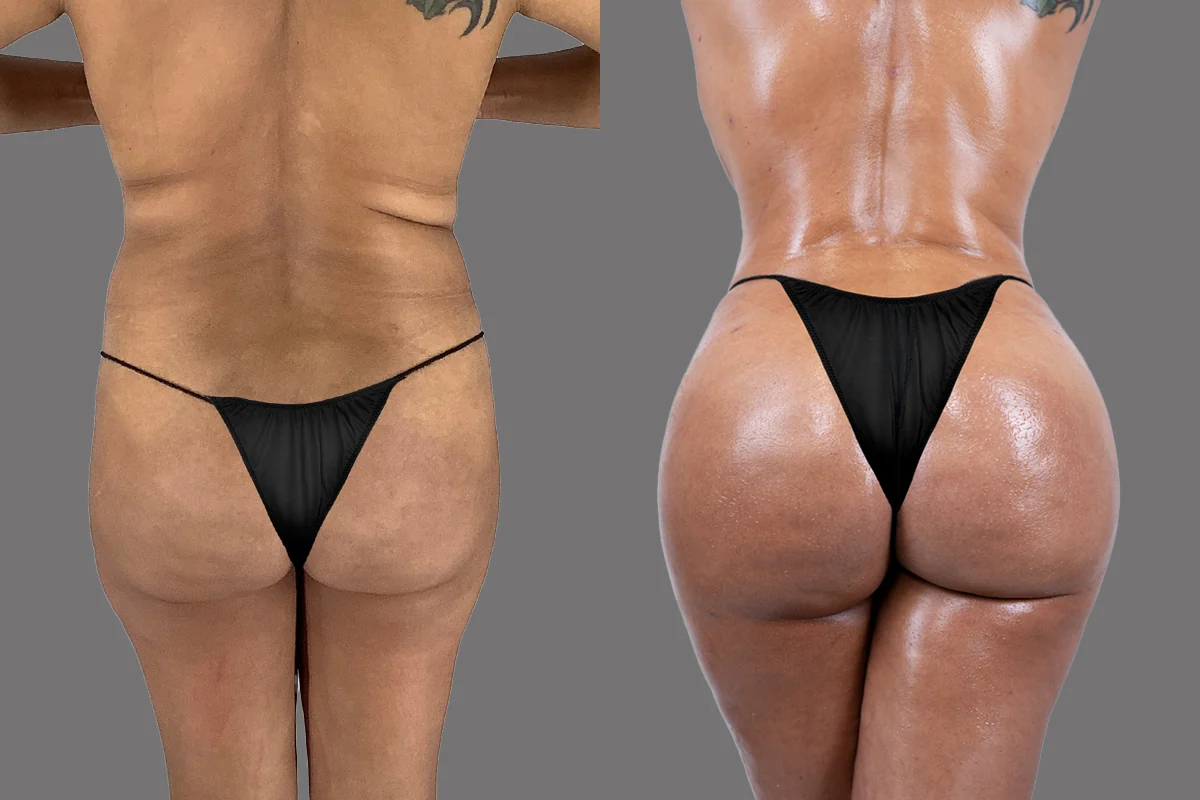 Before and after, patient 4