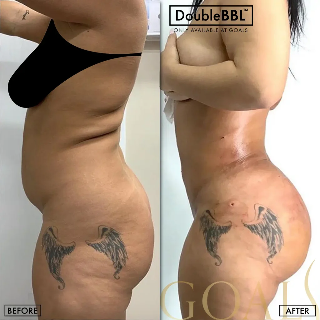Before and after, patient 1
