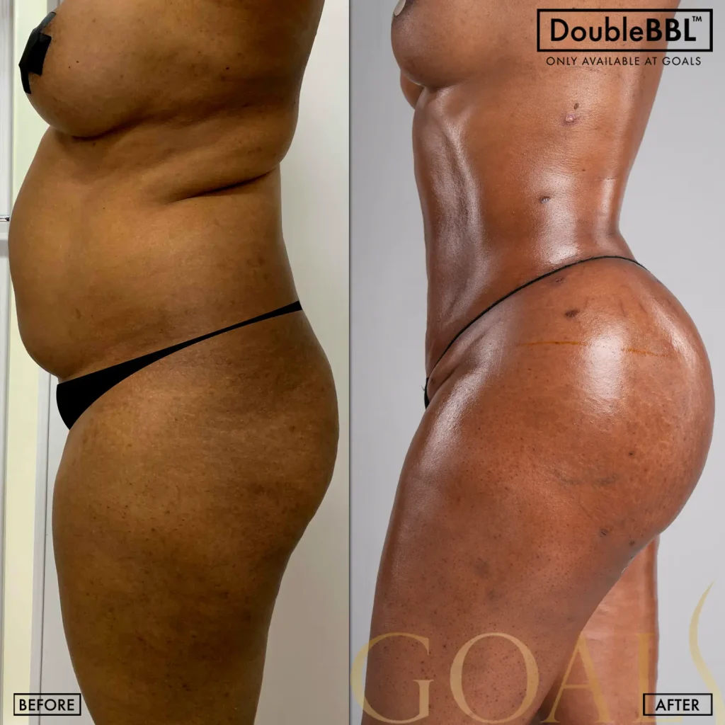 Before and after, patient 3