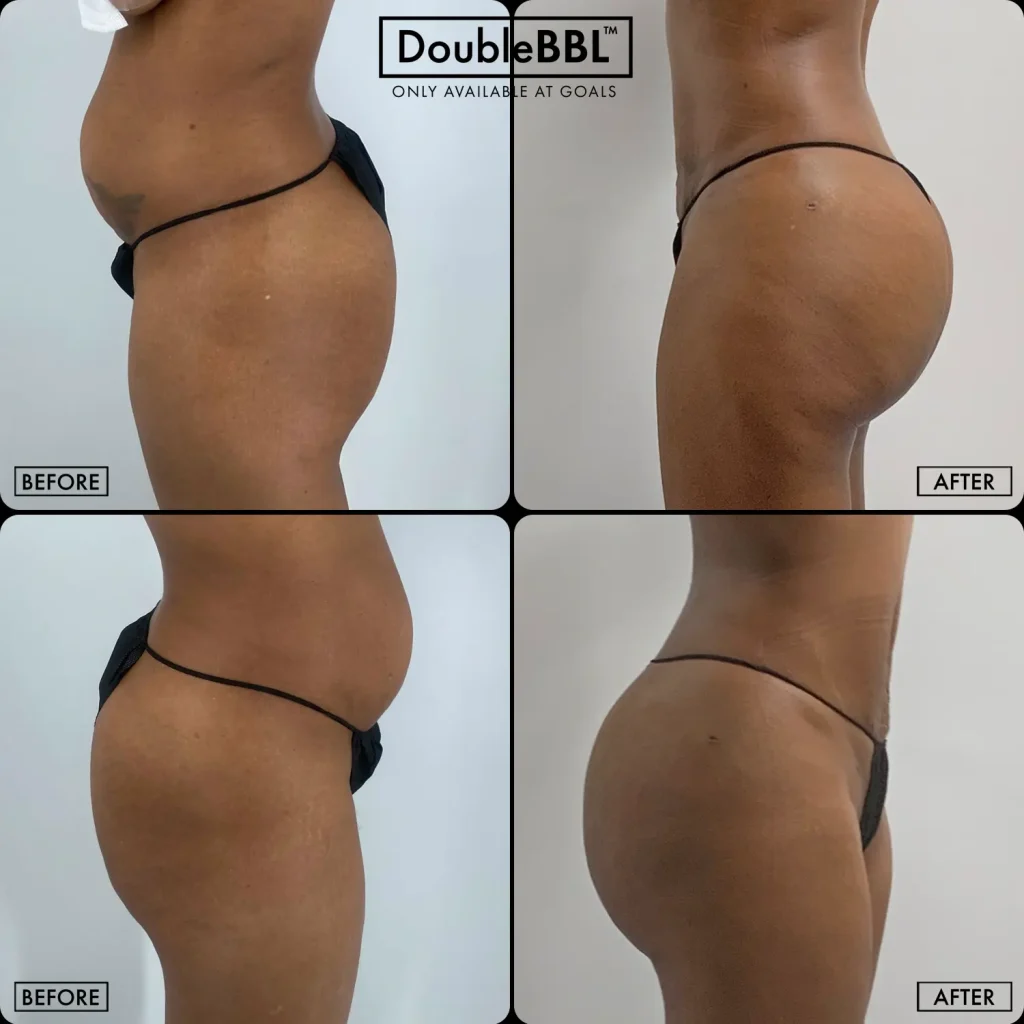 Before and after — Fair Lawn, patient 2