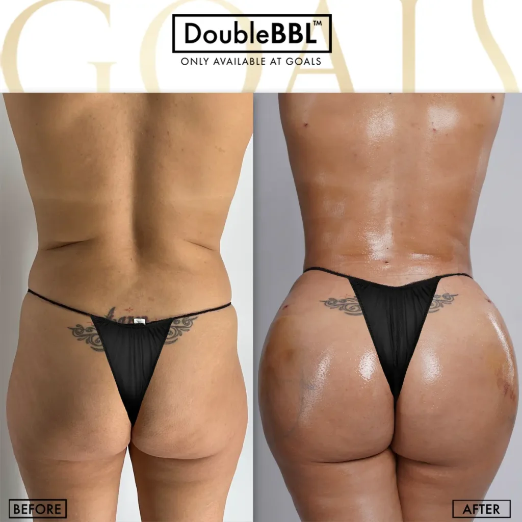 Before and after — Fair Lawn, patient 3