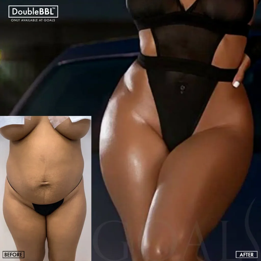 Before and after — Atlanta Tucker Rd., patient 3