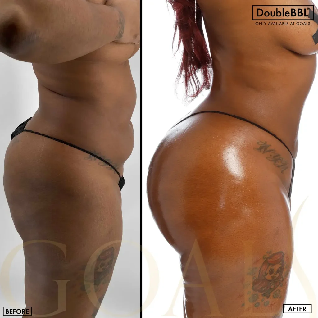 Before and after, patient 6