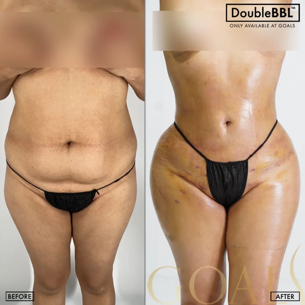 Before and after, patient 1