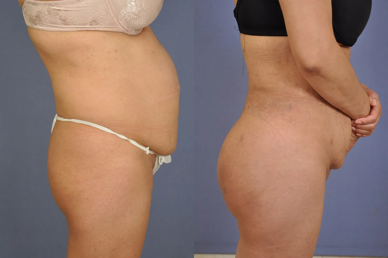 Before and after, patient 4
