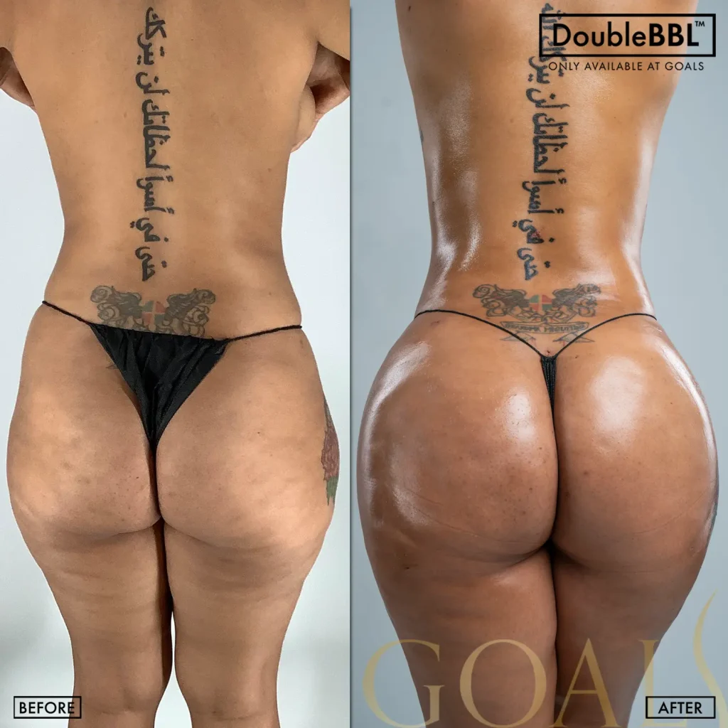 Before and after, patient 6