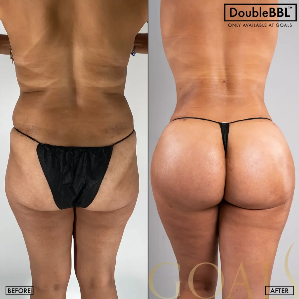 Before and after, patient 3