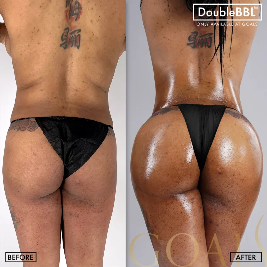 Before and after, patient 4