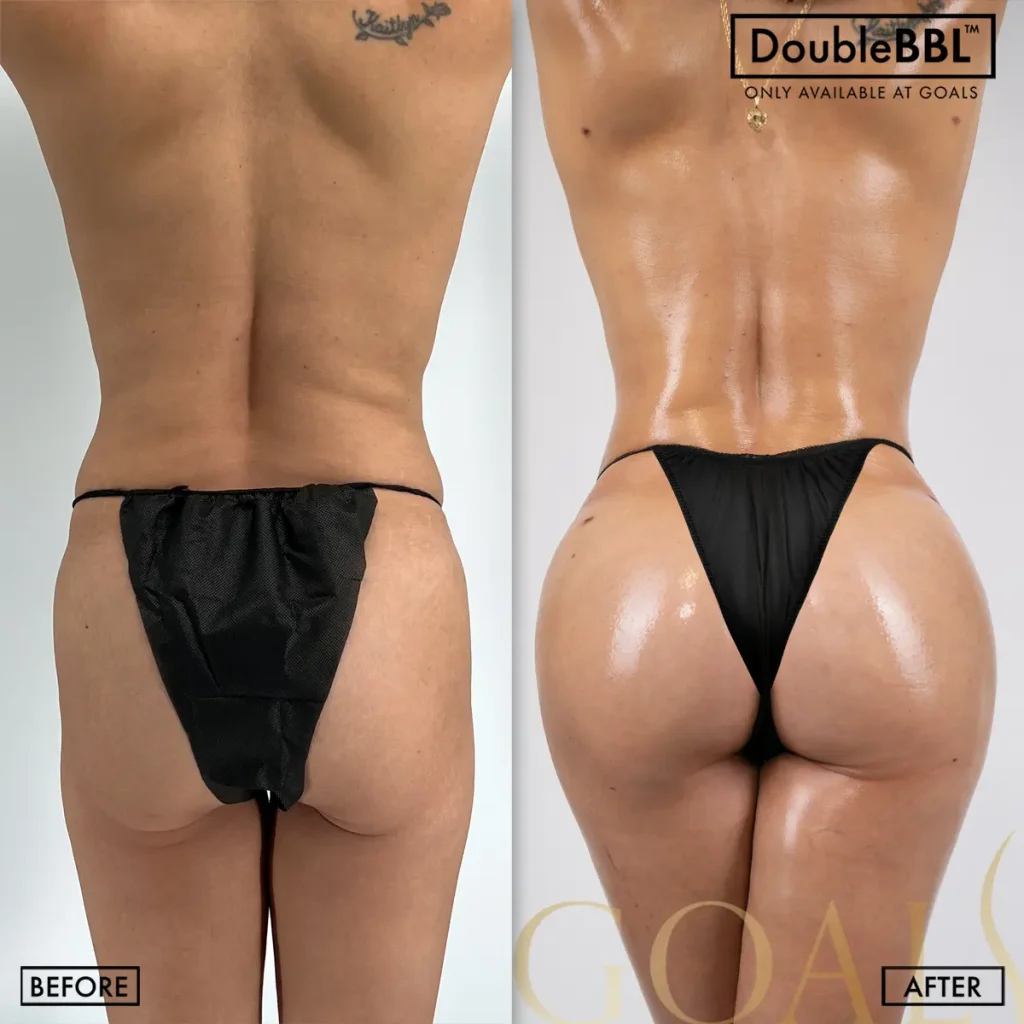 Before and after, patient 5