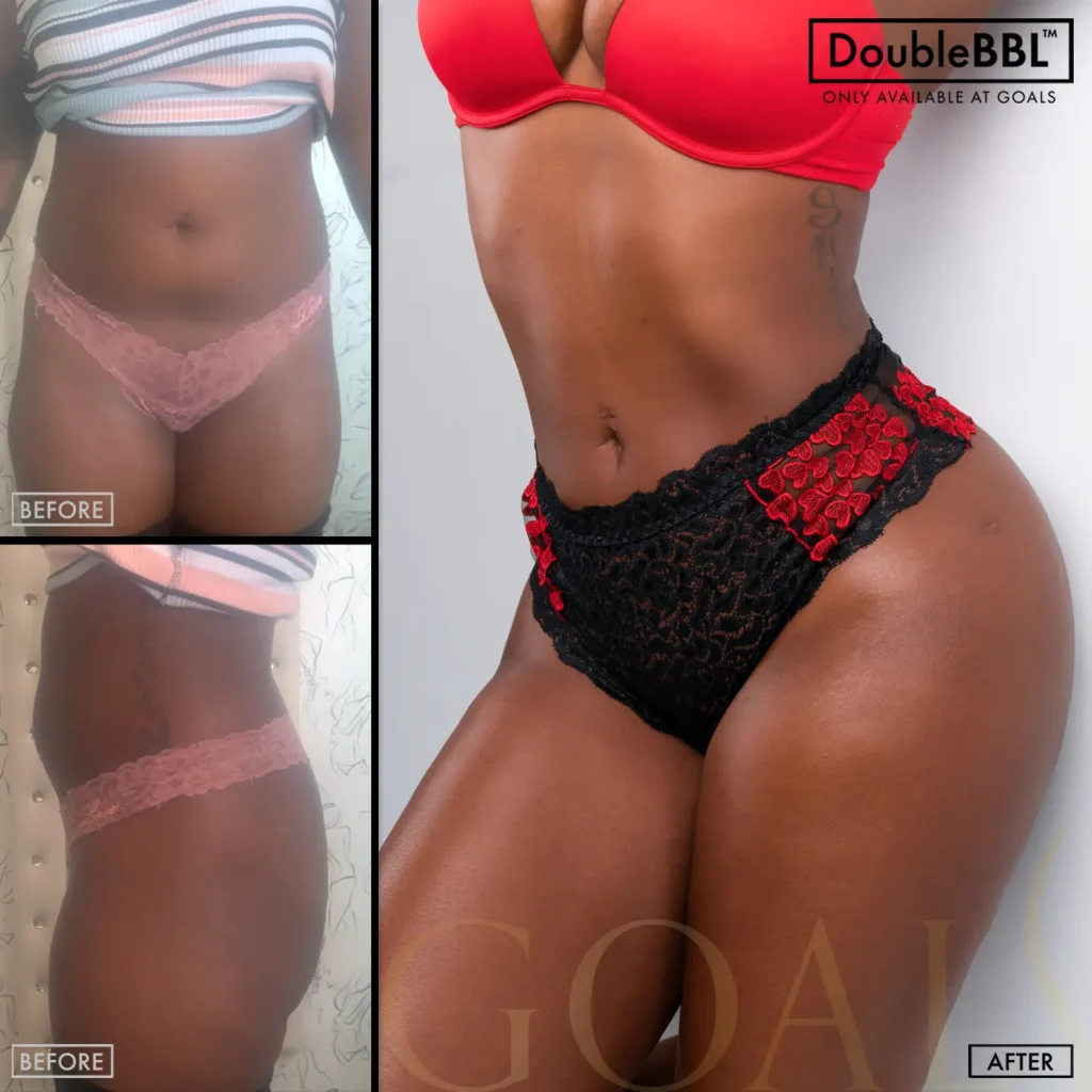 Before and after — Central Park, patient 2