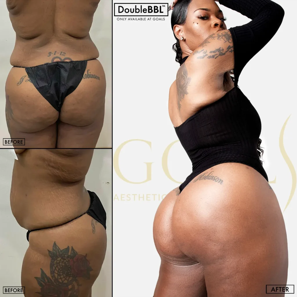 Before and after — Central Park, patient 3