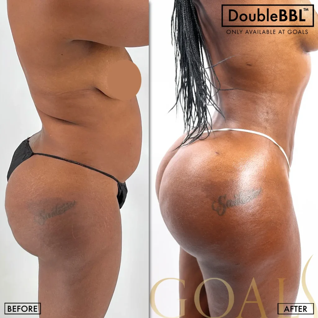 Before and after — Central Park, patient 5