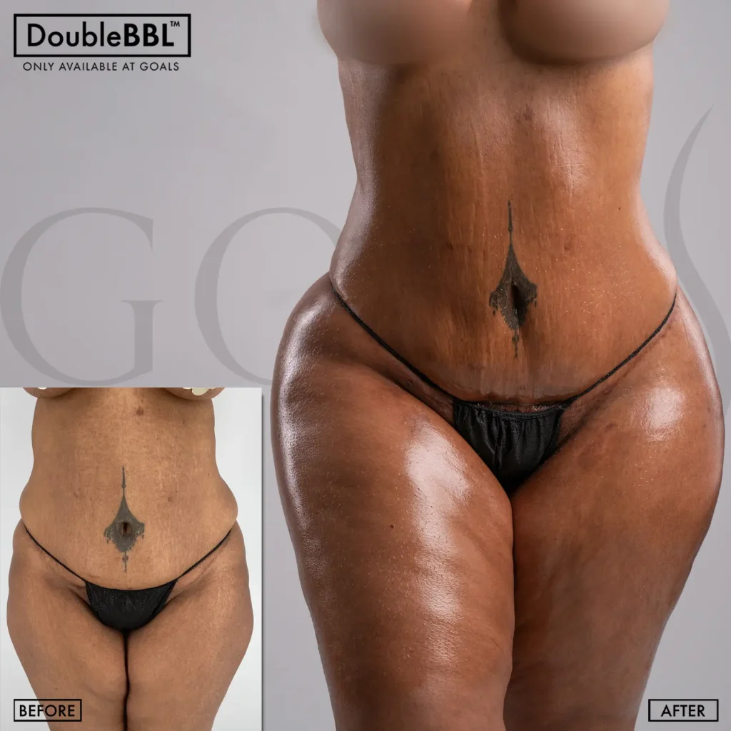 Before and after — Gaithersburg, patient 3