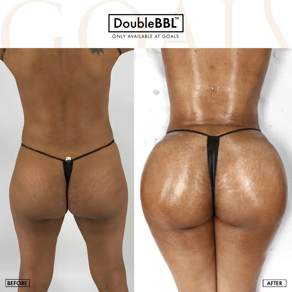 Before and after — Los Angeles, patient 5