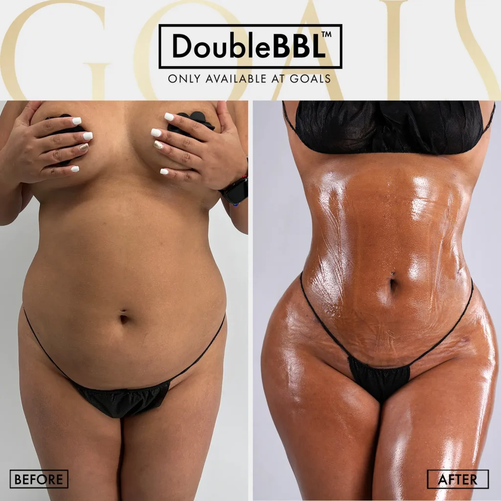 Before and after — Brooklyn, patient 1