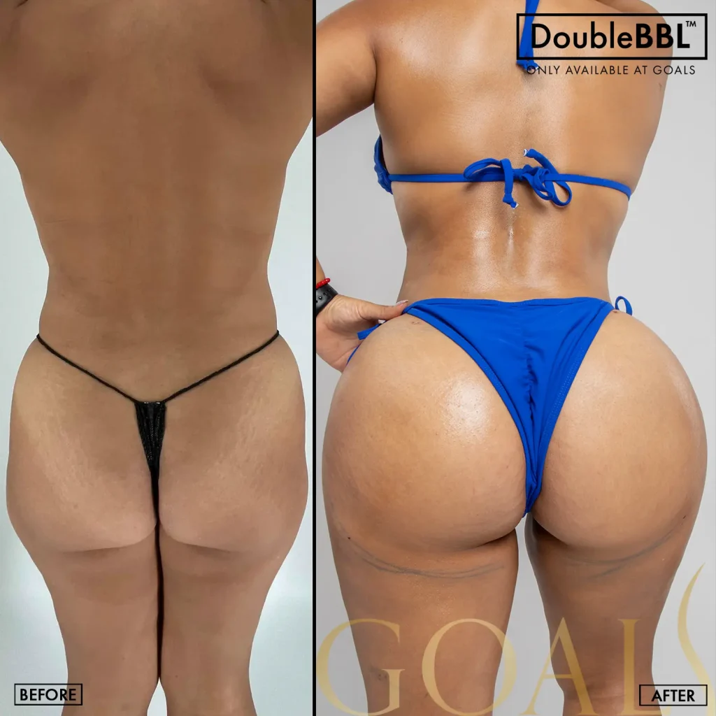 Before and after — Brooklyn, patient 4