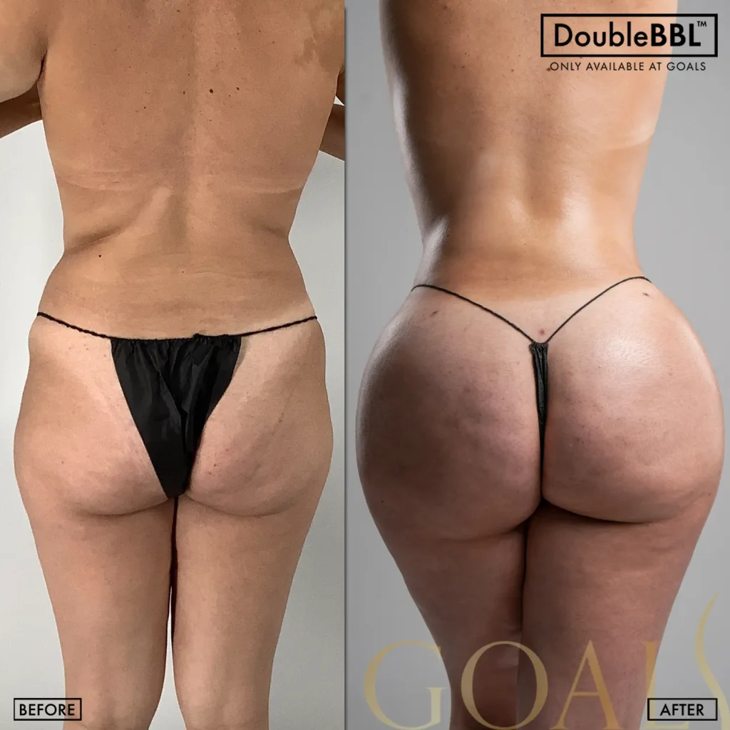 Before and after, patient 1
