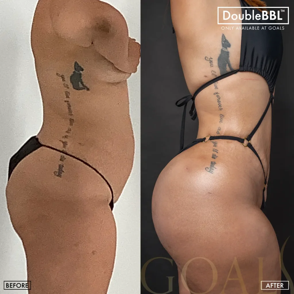 Before and after, patient 2