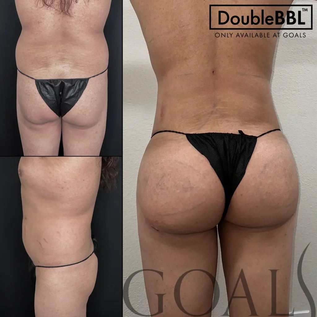 Before and after, patient 3