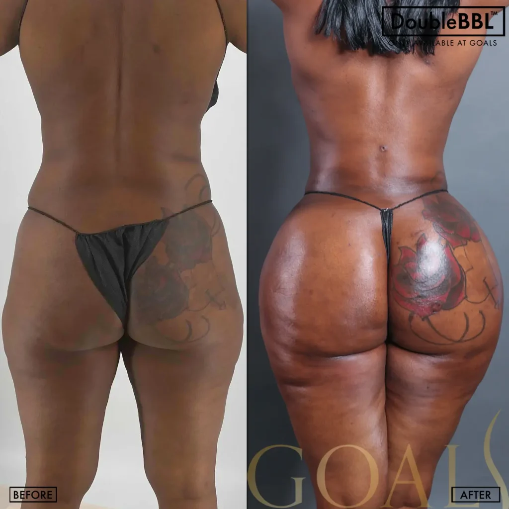 Before and after, patient 2