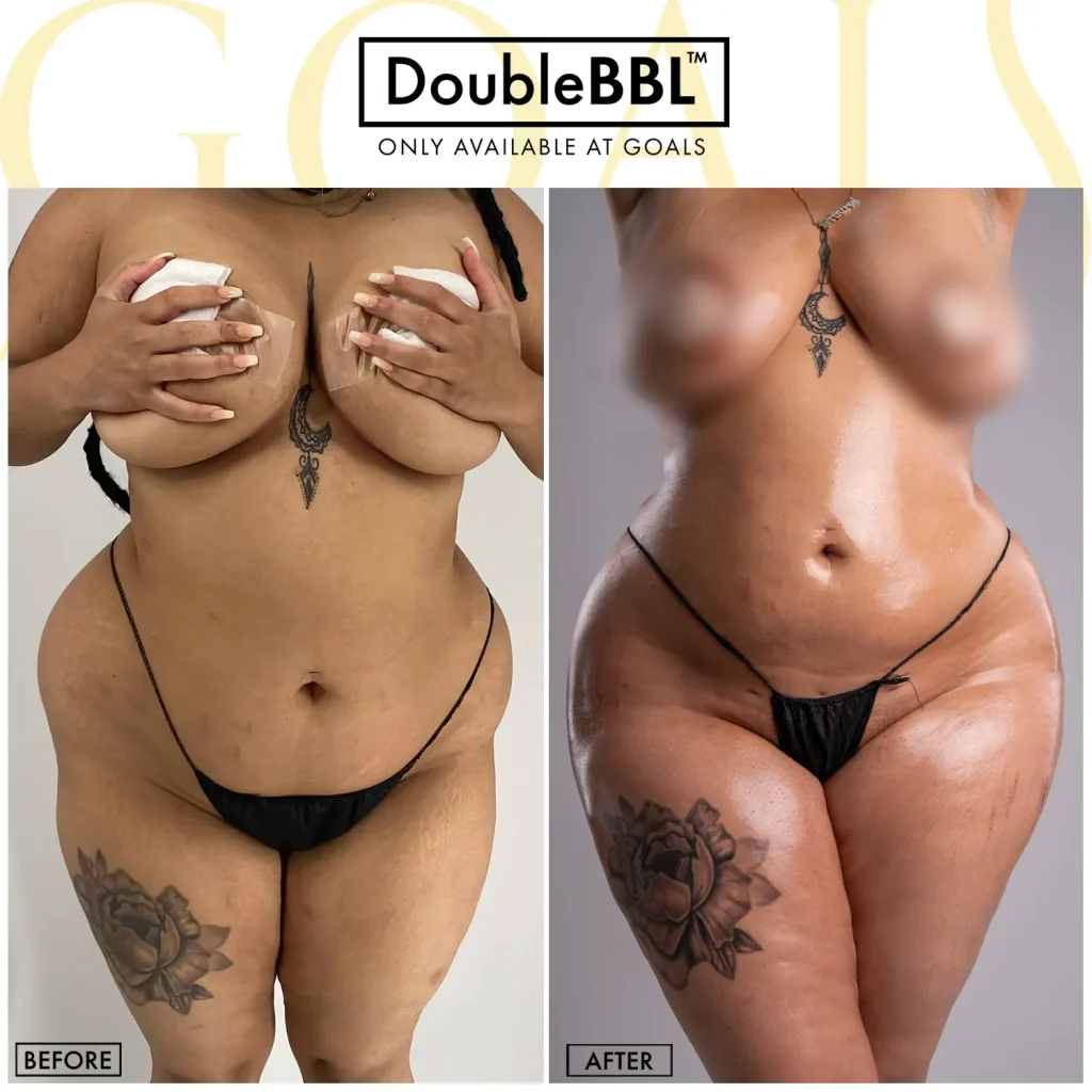 Before and after, patient 3