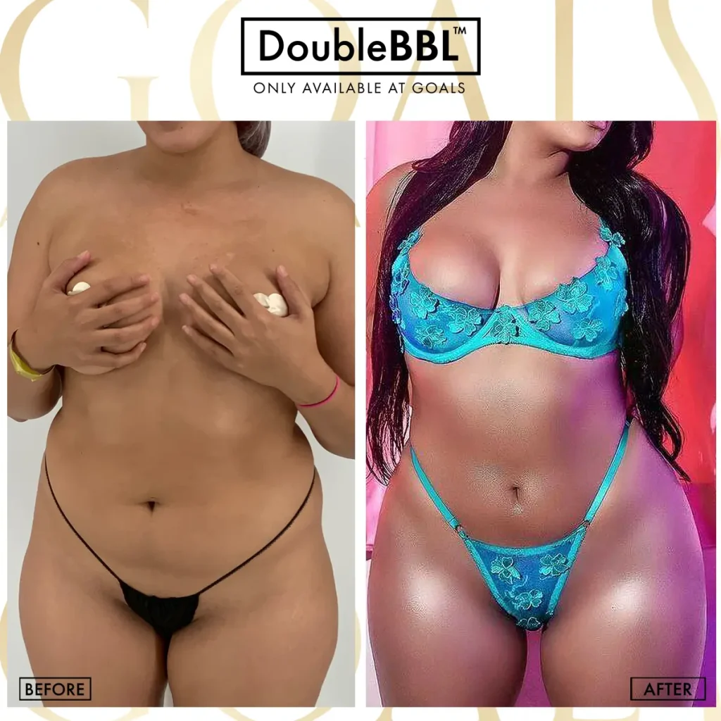Before and after, patient 6