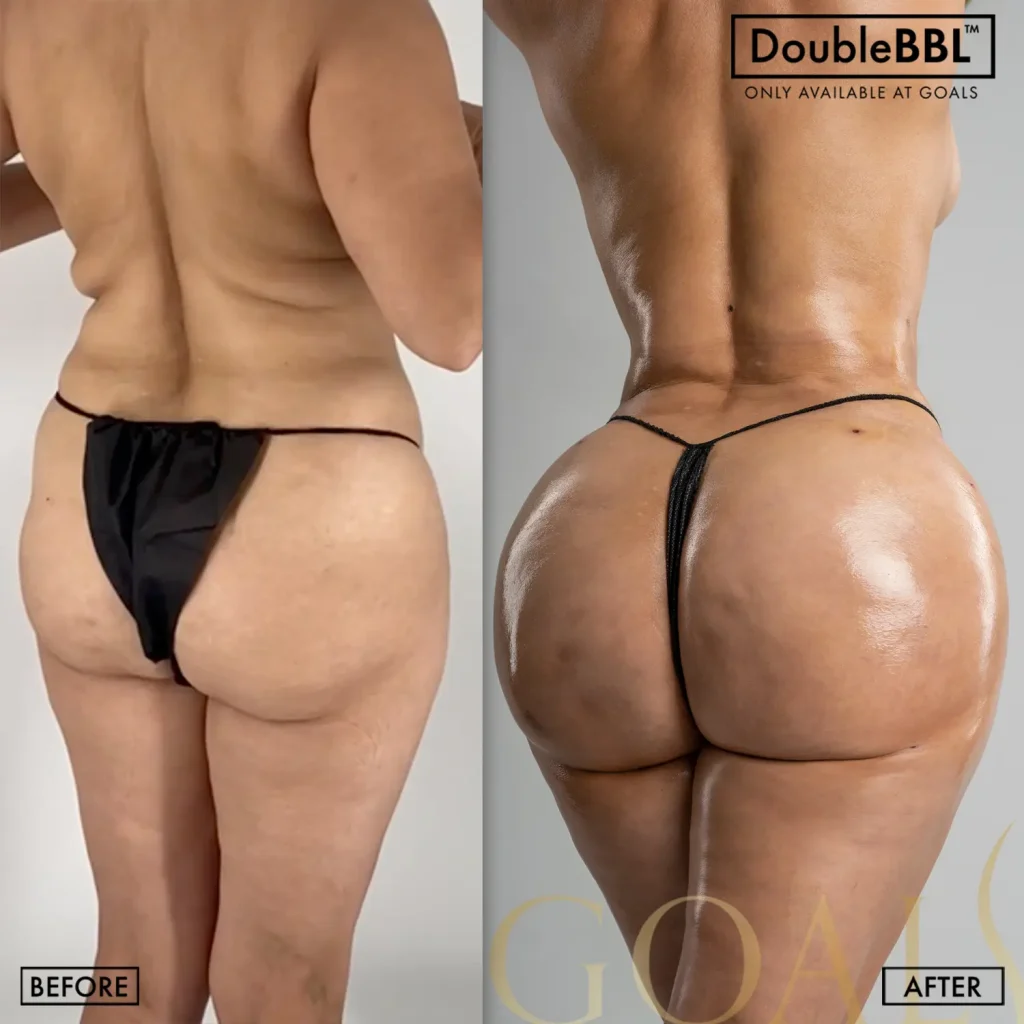 Before and after — Ridgefield, patient 3