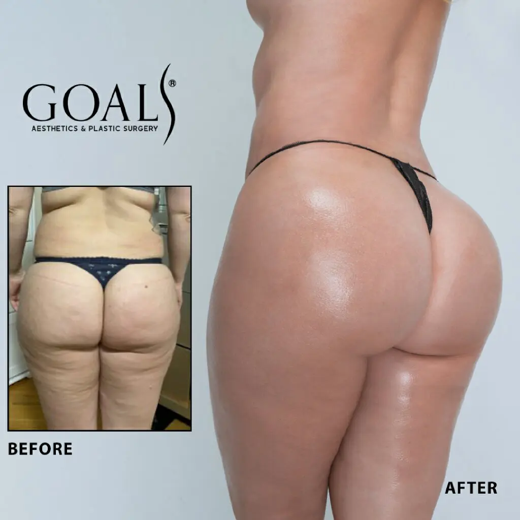 Before and after — Ridgefield, patient 4