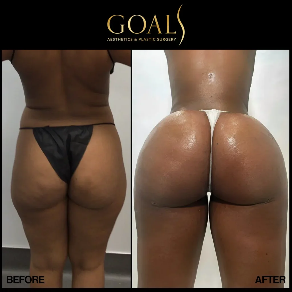 Before and after — Houston, patient 4
