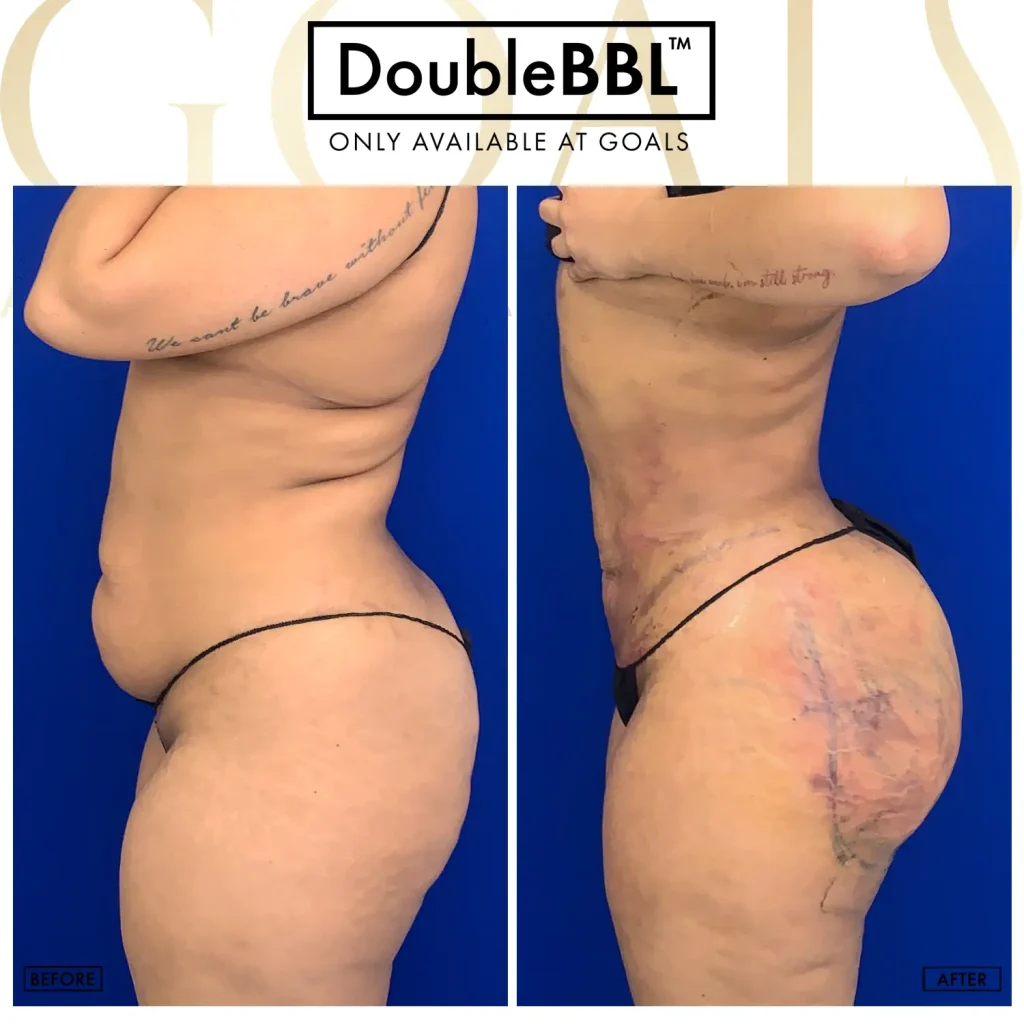 Before and after — Houston, patient 5