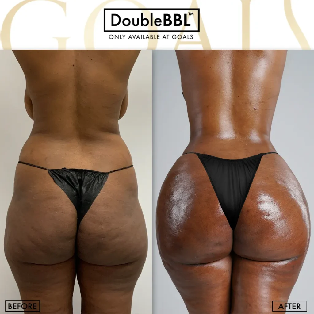 Before and after — Gaithersburg, patient 1