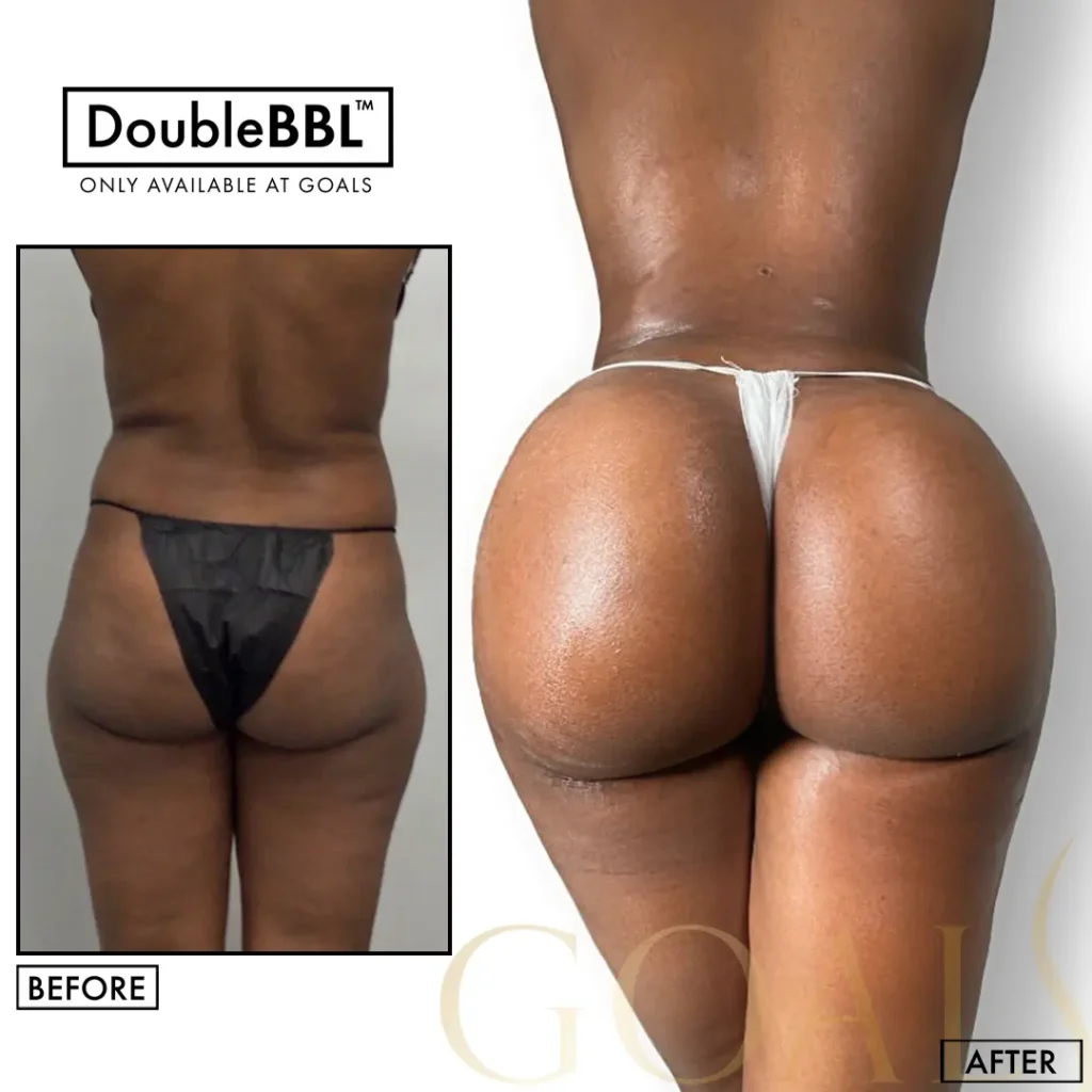 Before and after — Gaithersburg, patient 3