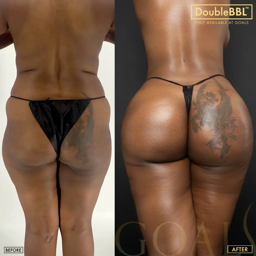 Before and after, patient 1
