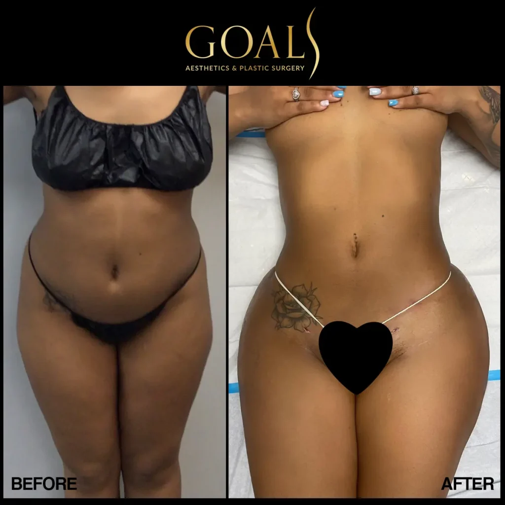 Before and after, patient 3