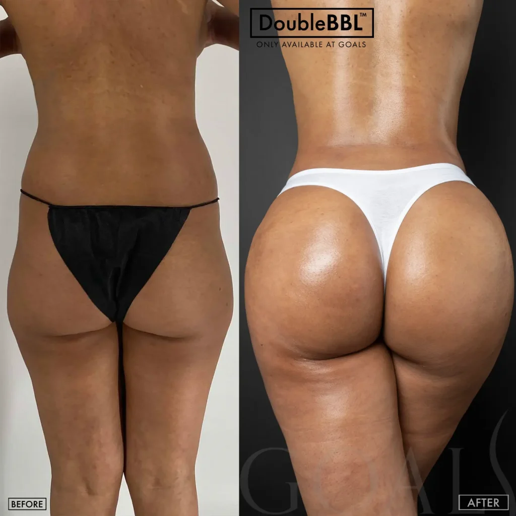 Before and after, patient 5