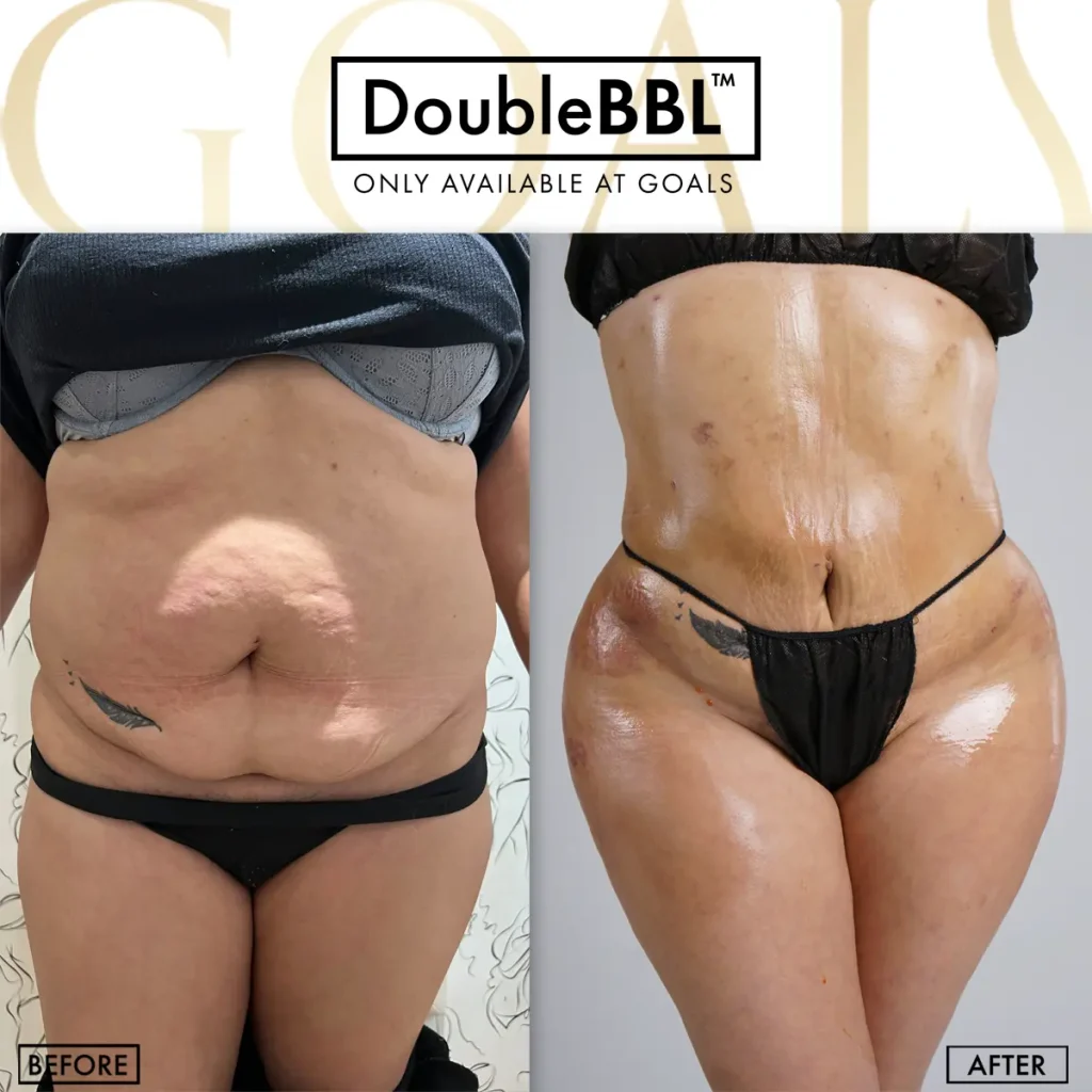 Before and after, patient 6