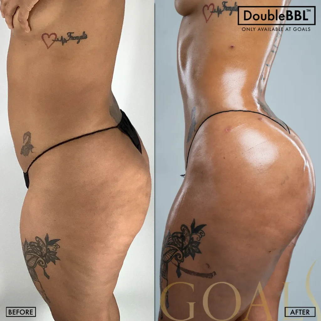 Before and after — Brooklyn, patient 6