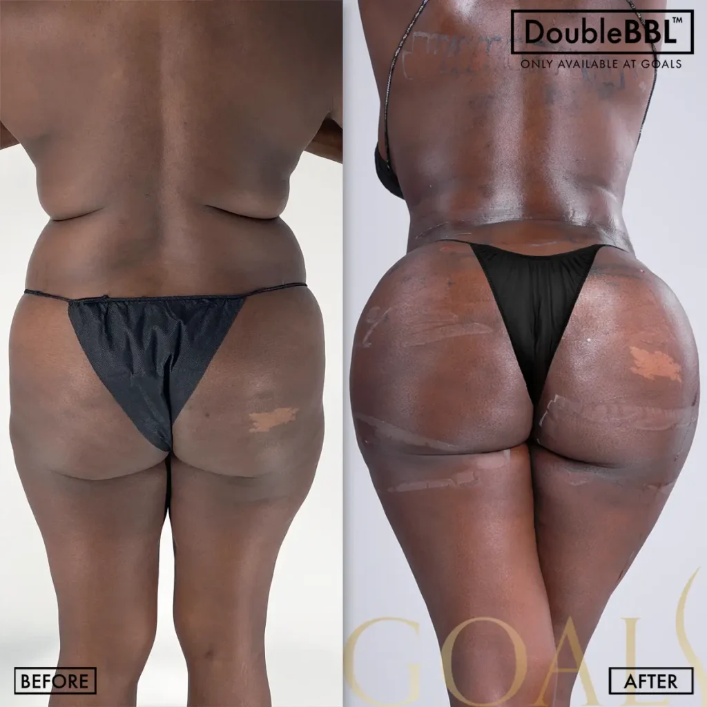 Before and after — Philadelphia, patient 5